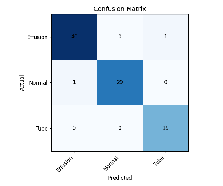 Confusion matrix of the eardrum triage model on held-out data